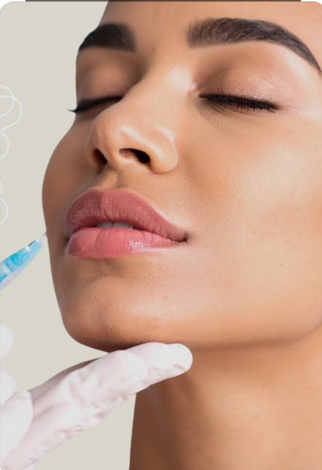 Dermal filler injection treatment